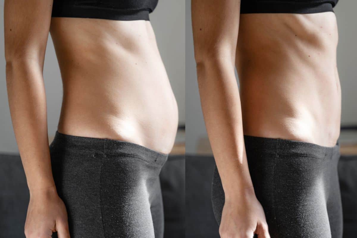 Post-Pregnancy: What Happens to Your Abdominal Muscles After Birth Telford