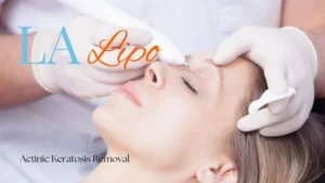 Woman receiving Actinic Keratosis Removal Treatment Telford