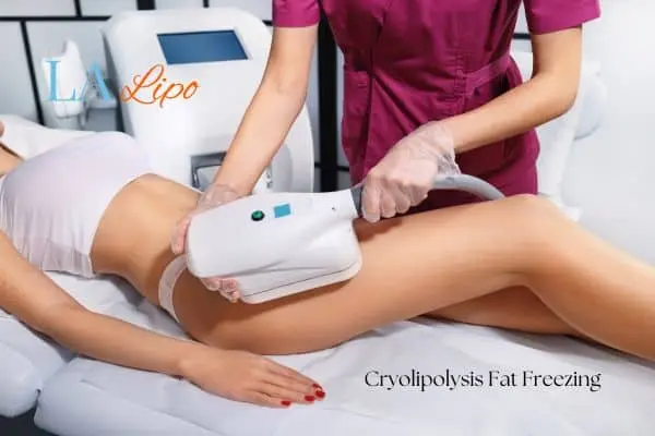 Woman receiving coolsculpting Telford treatment on her thighs