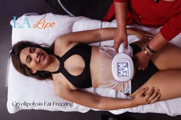 woman getting cryolipolysis Telford