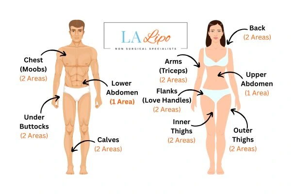 LA LIPO Cryolipolysis Areas Telford