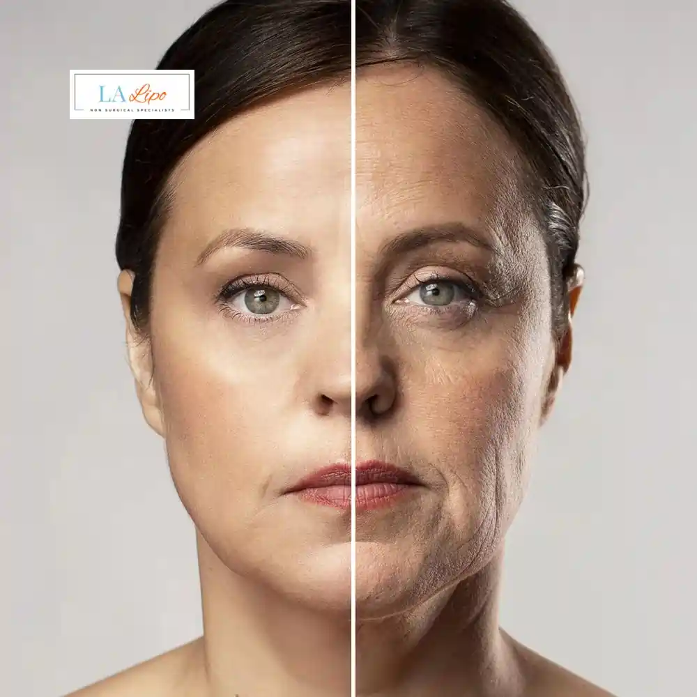 How Can You Tell If Non-Surgical Skin Tightening Is Right for You Telford?