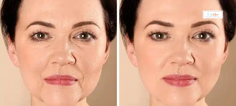 How Long Does It Take to See Results and How Long Do They Last Telford?