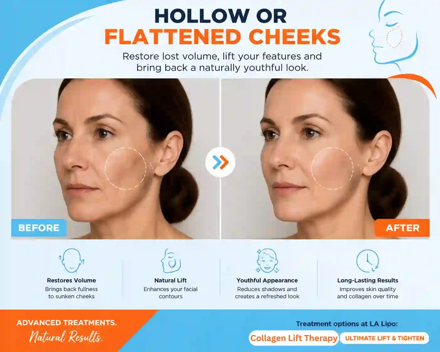 Sign #4: Hollow or Flattened Cheeks Telford
