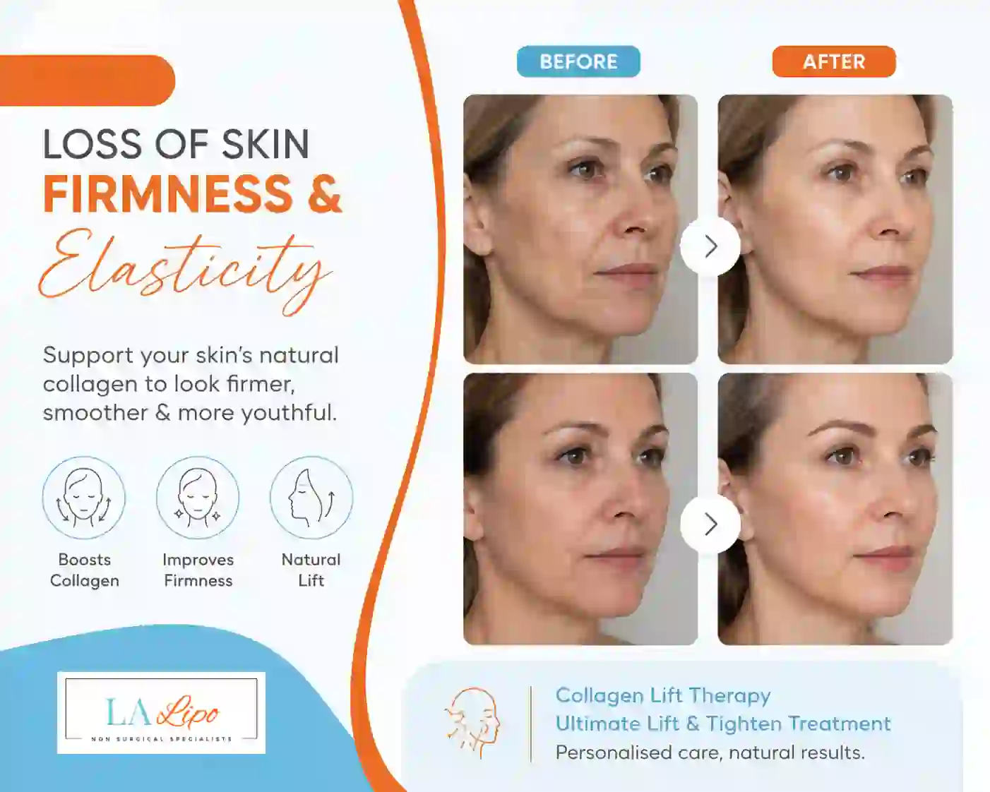 Sign #7: Loss of Skin Firmness and Elasticity Telford